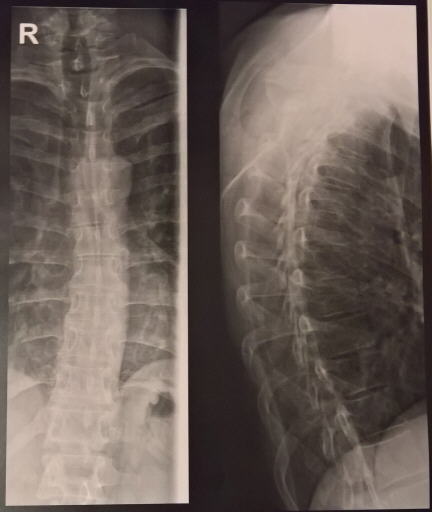 back-x-ray.jpg